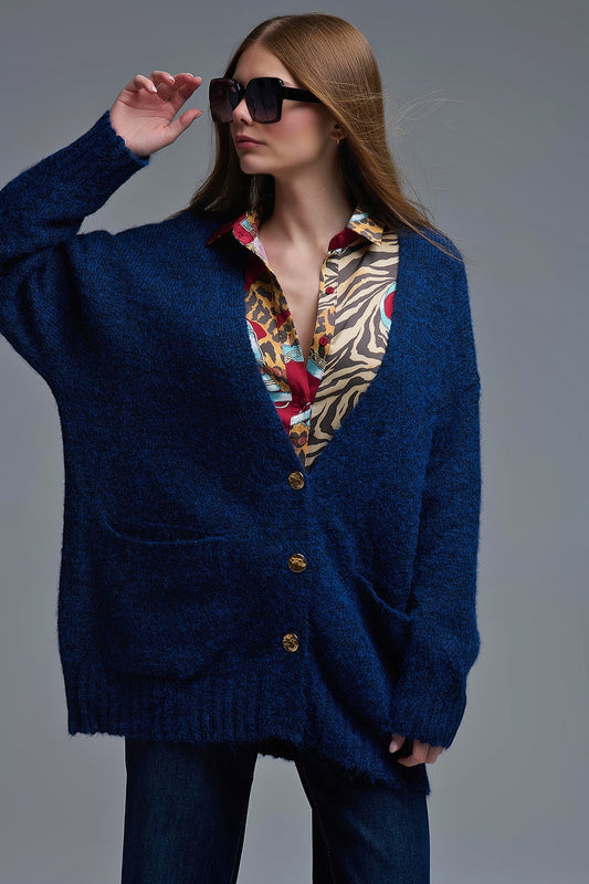 Q2 Oversized Cardigan in Navy with gold buttons and pockets